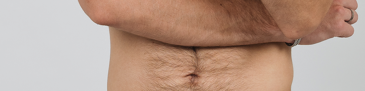 Intimate Shaving Men | Avoid Razor Buds After Intimate Shaving